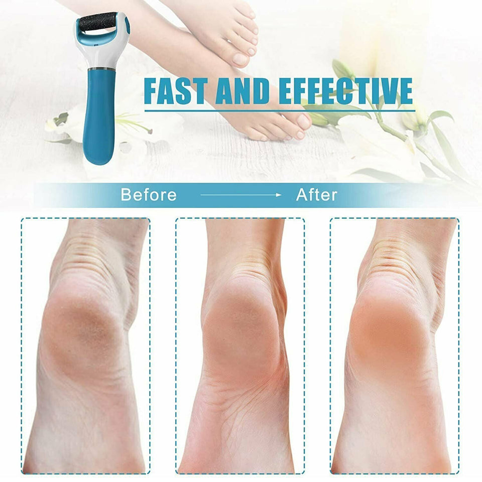 0229 Electronic Dry Foot File, Callous Remover for Feet, Electric Foot with Roller Hard and Dead Skin- Regular Coarse, Baby smooth feet in minutes. For in home padicure foot care, Battery Powered & USB (Battery not included)